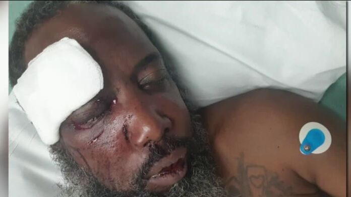 bicyclist-attacked-by-neighbor